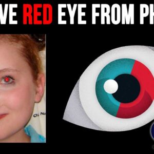 Free Red Eye Remover App